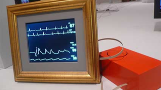 Telepresence Frame: A Black Box for Life Support Patients